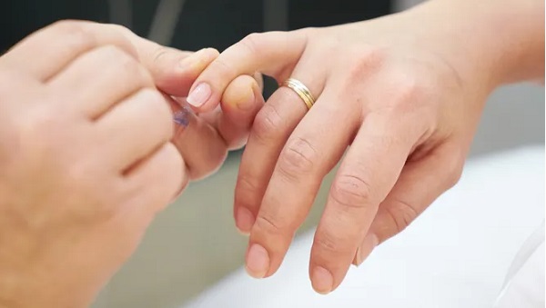 Британская ассоциация дерматологов: как по ногтям человека определить, переболел ли он коронавирусом