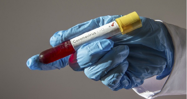 Число заражений коронавирусом в мире приближается к первому миллиону: данные на 31 марта